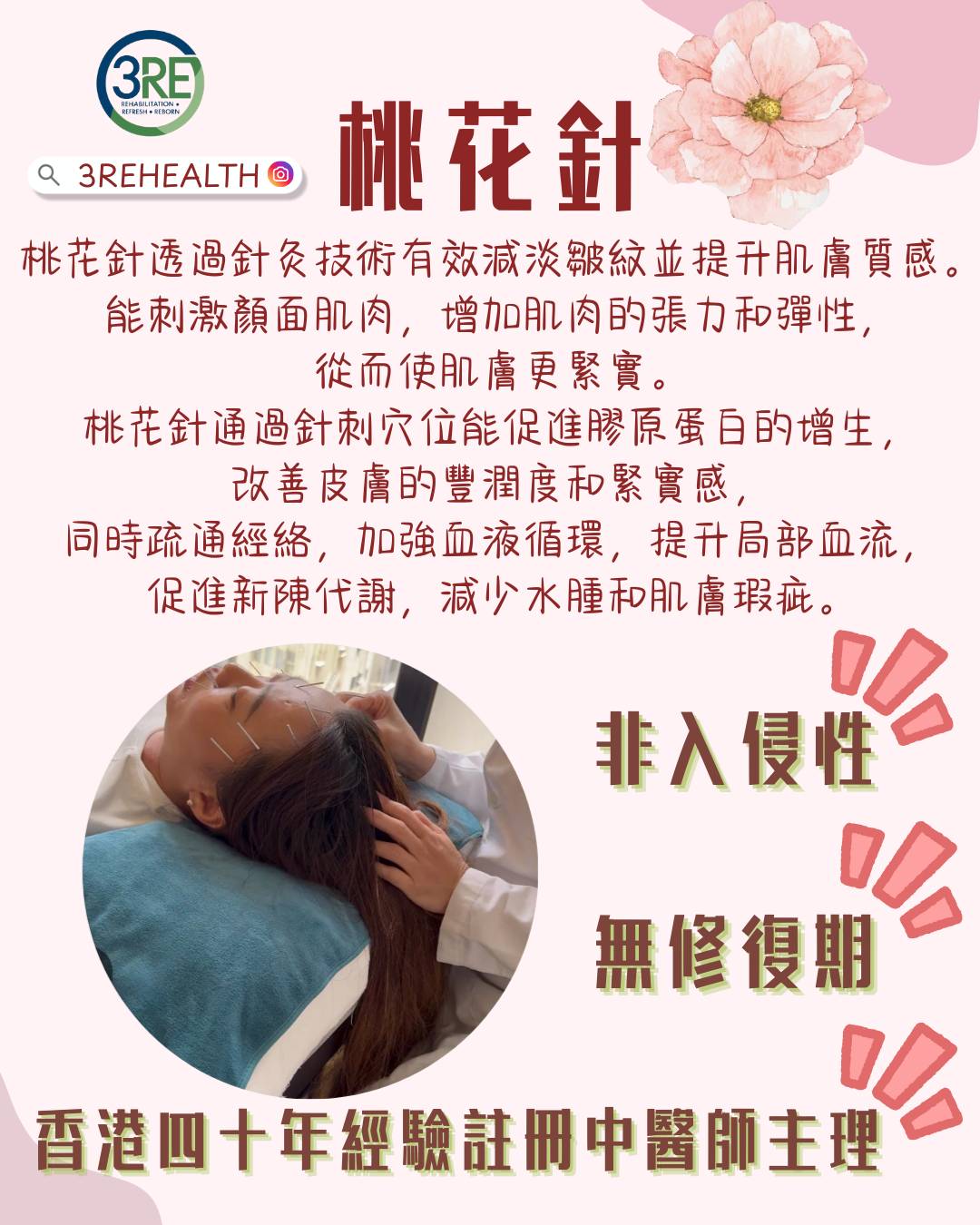 3RE 中醫療程—桃花針 — 四十年註冊中醫主理